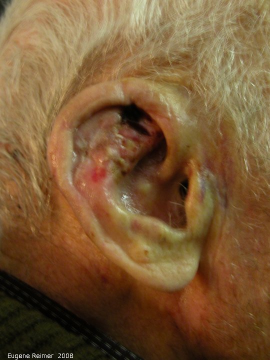 IMG 2008-Jan04 at Steinbach (Dad visits the ITR):  Dad injured ear