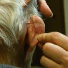 Dad: injured ear